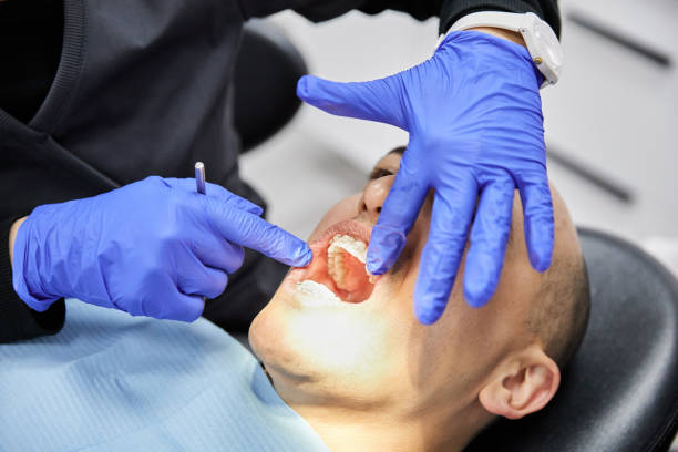 Best Emergency Wisdom Teeth Removal in Mount Morris, IL
